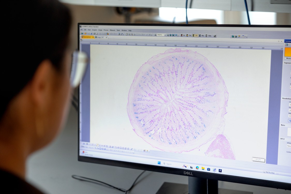 Melissa Huang examines a cross section of an empryonic chicken small intestine in her Stocking Hall lab. Spent brewers' grain (BSG) is frequently used as cattle and hog feed. For broilers and laying hens, enzymes must be added to make it digestible. In a paper in an “Animals” special issue, “A Paradigm Shift—Precision Poultry Nutrition and Alternative Poultry Feed Ingredients Using Novel Feed Processing Methods” explores the upcycled opportunities of spent grain as a sustainable dietary ingredient with health and nutritional benefits for broiler chickens, using a method where a substance is directly injected into the amniotic sac of a pregnant animal, essentially "feeding" the fetus through the amniotic fluid to determine precise nutrient benefits.